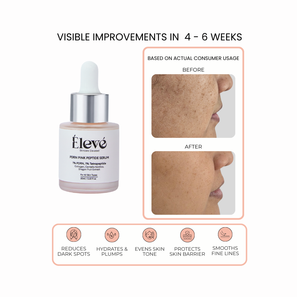 Before and after results showing visible skin improvement after 4–6 weeks of using Eleve PDRN Pink Peptide Serum